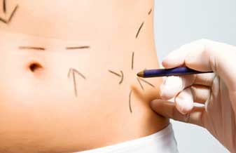 Márcio Lima Leal Arnaut - Foto 1